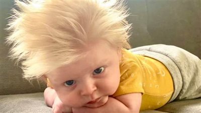 شاهد.. طفل مولود بشعر أشقر غزير.. وتقارير عالمية يشبهونه برئيس وزراء بريطانيا