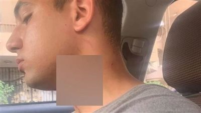  أب اعتدى على نجله بـ سكين في مدينة نصر..وجهات التحقيق تأمر بحبسه