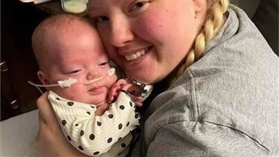 امرأة برحمين تلد طفلتين بكل رحم 