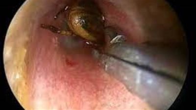 بعد أيام من الألم.. 