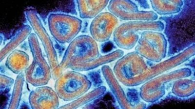 عوض تاج الدين يفجر مفاجأة جديدة عن فيروس ماربورج