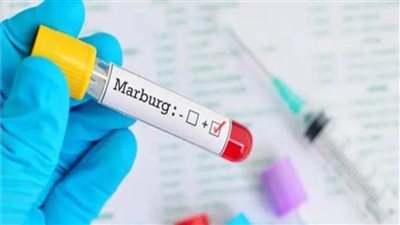 إسبانيا ترصد أول إصابة محتملة بفيروس ماربورج لديها 