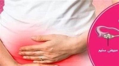 تكيس المبايض لدى النساء، مخاطر قد تنتقل للأبناء الذكور