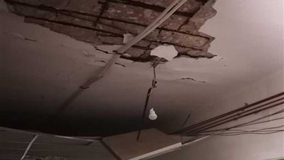 جامعة سوهاج: لا توجد إصابات جراء سقوط سقف بقسم العظام