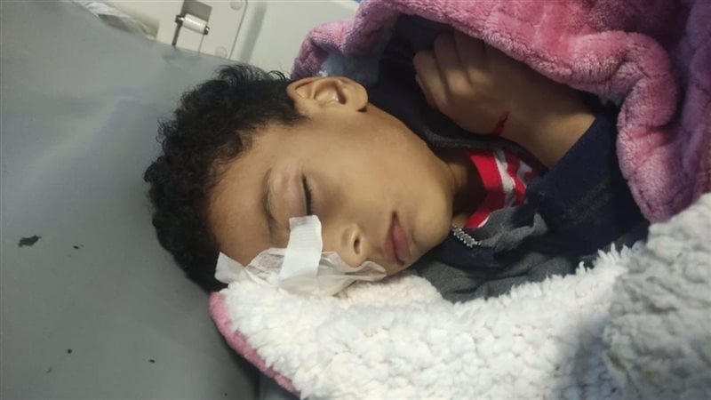 الطفل المصاب