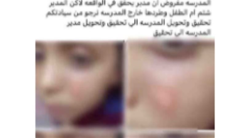 الشورى
